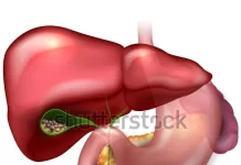 पित्ताशय की पथरी/गॉलस्टोन का इलाज — विद्यावाचस्पति डॉक्टर अरविन्द प्रेमचंद जैन भोपाल