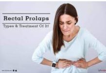रेक्टल प्रोलेप्स का खतरा —-विद्यावाचस्पति डॉक्टर अरविन्द प्रेमचंद जैन भोपाल