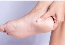 एड़ी का दर्द-विद्यावास्पति डॉक्टर अरविन्द प्रेमचंद जैन भोपाल