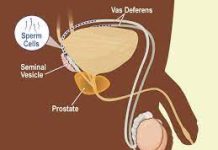 शुक्राणु /स्पर्म बढ़ाने के उपाय—–विद्यावाचस्पति -डॉक्टर अरविन्द प्रेमचंदजैन भोपाल